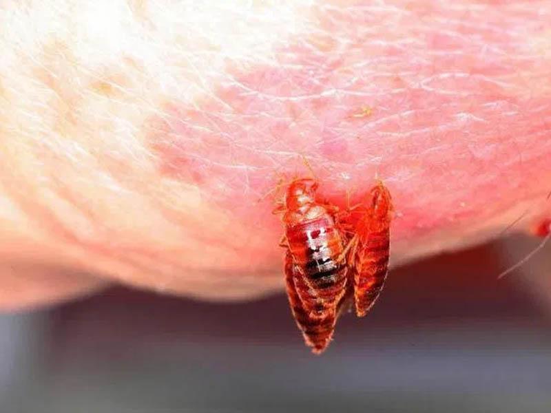 How and what to treat bed bug bites on the human body