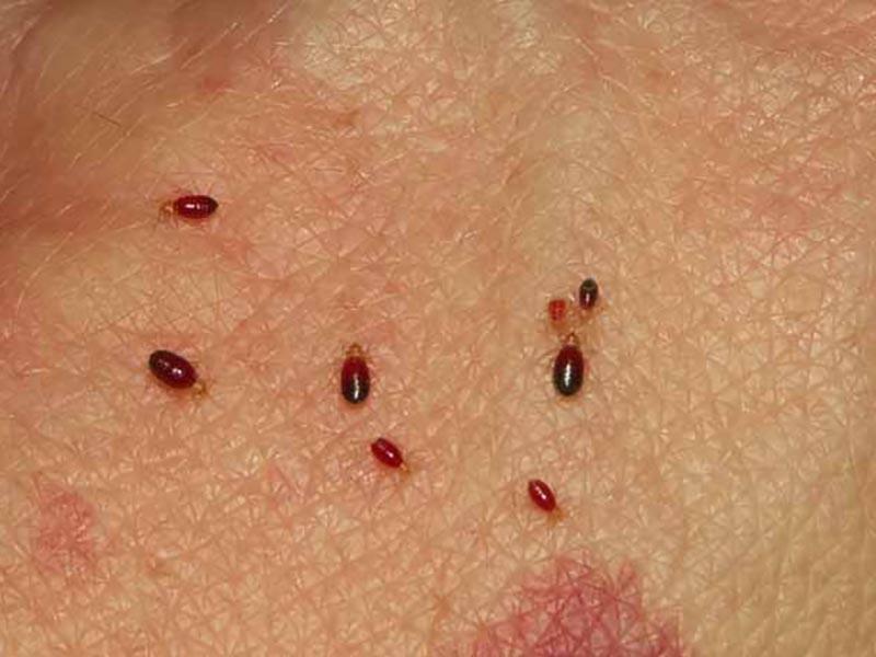 Bed bugs in the couch couch bed bugs how bites look and how to remove them at home 13
