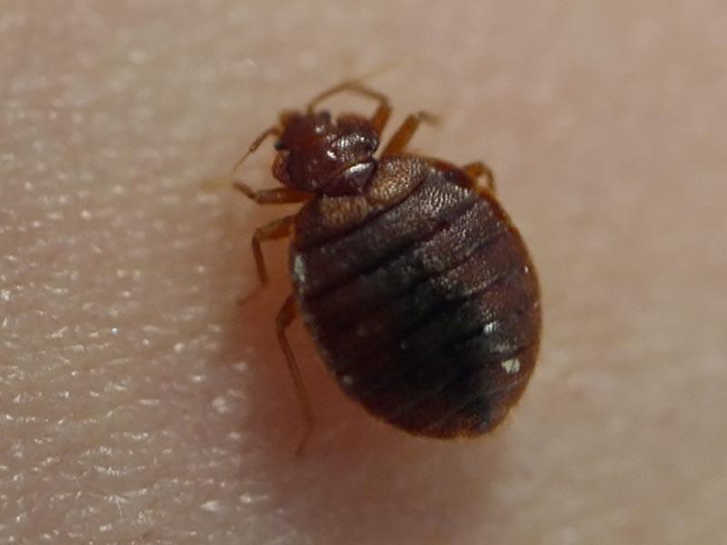 Bedbugs on a child's body